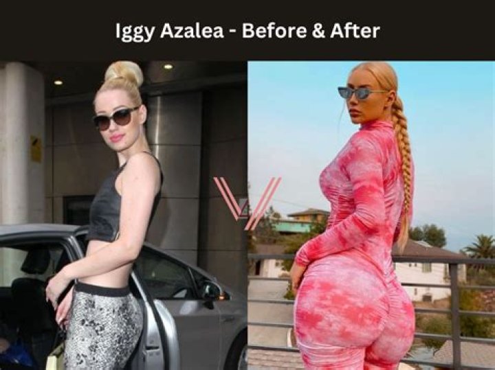 Iggy Azalea Leaks: Unpacking the 2019 Photo Incident and Her Response